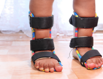 Child with leg braces